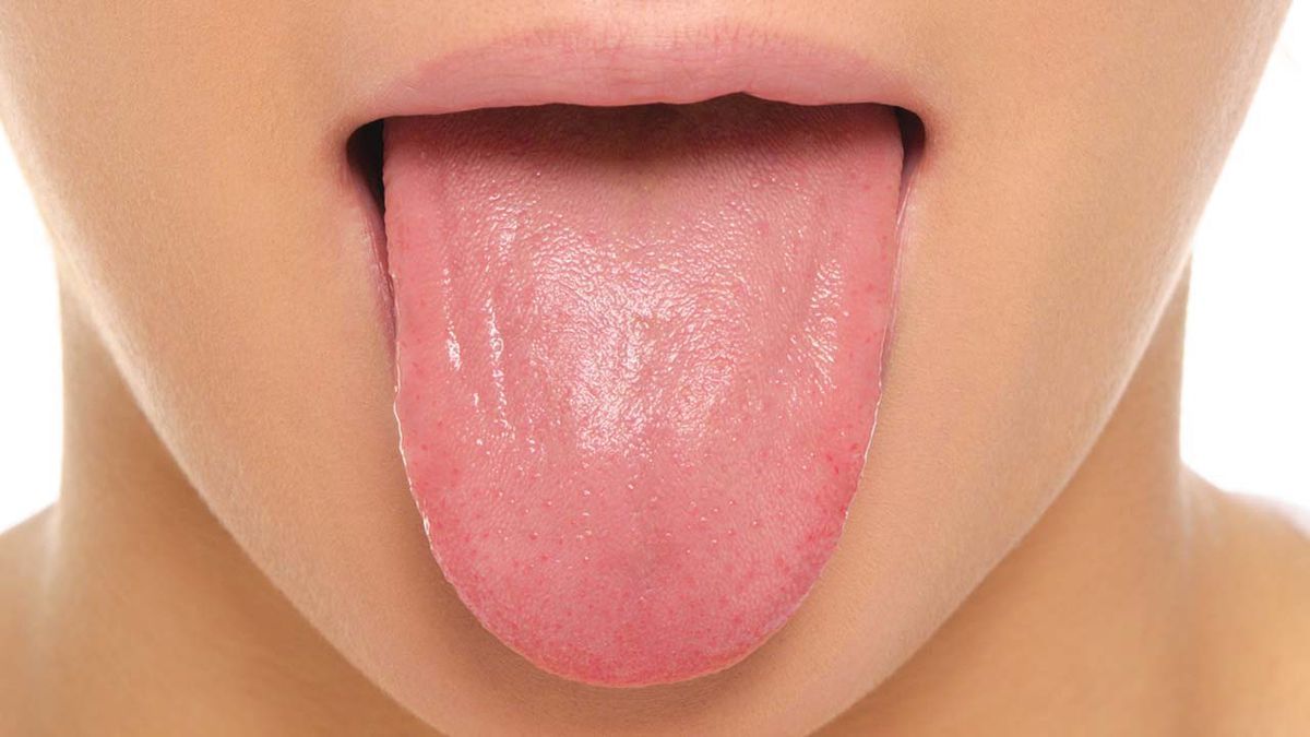 sticky-tongue-problems-you-want-to-stay-away-from-its-the-vibe